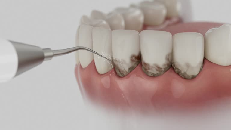 Reliable Dental contractor in Brooklyn Center, MN by Dentist Open Now